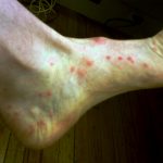 bolhacsipes_bolhairtas